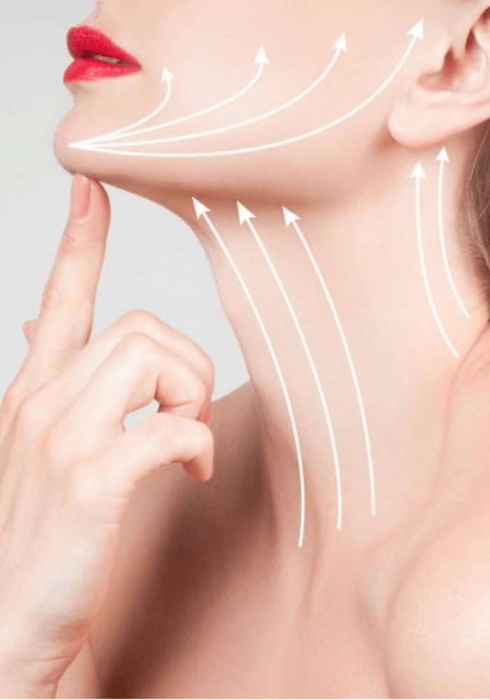 Neck Lift Surgery Results — Lower Rhytidectomy Before and After